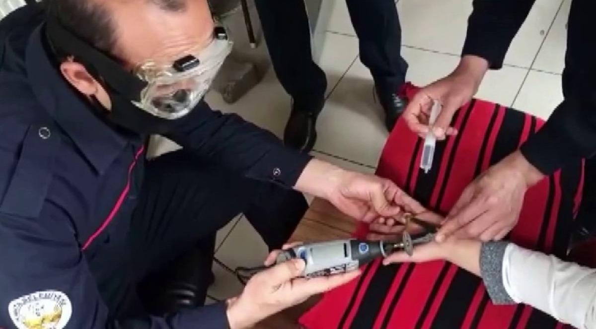 Parmağa sıkışan y&uuml;z&uuml;k kesilerek &ccedil;ıkarıldı