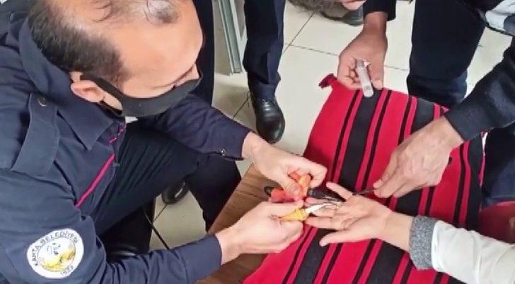 Parmağa sıkışan yüzük kesilerek çıkarıldı G3