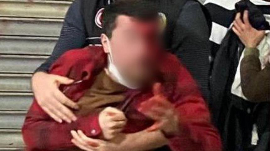 Polisin darp ettiği iddia edilen vatandaş kendisini eylemcilerin yaraladığını söyledi