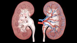 Böbrek nakli sonrası 3 aya dikkat! Şeker hastaları bağışçı olabilir mi?