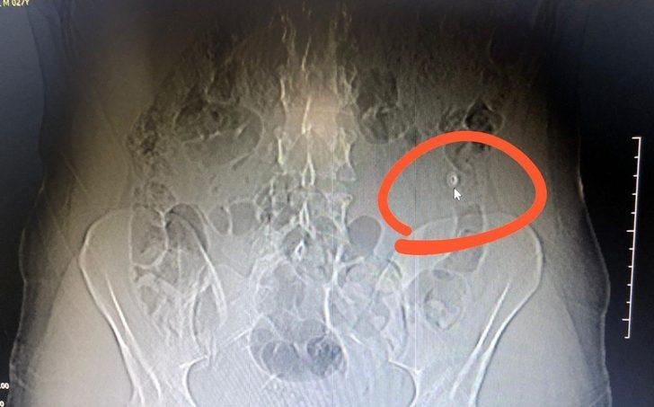 Karşısında polisleri görünce gerçekten hapı yuttu G3