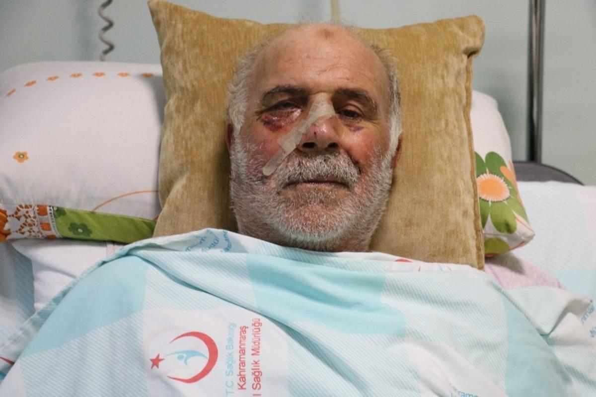 Demir keserken y&uuml;z&uuml;n&uuml; par&ccedil;aladı