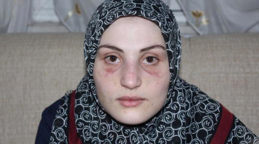 Kaçarak evlendiği kocası, hayatını zindana çevirdi!