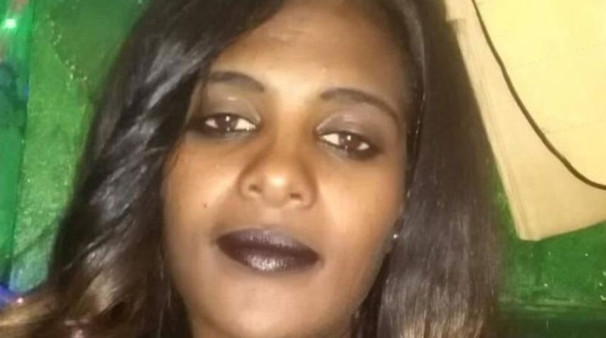 Kocasına kapıyı a&ccedil;tı, zalim adam y&uuml;z&uuml;ne asit attı! Sadece ağlayabiliyor