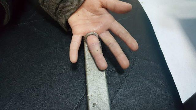 Parmağının sıkıştığı demir parçasıyla birlikte hastaneye kaldırıldı 1