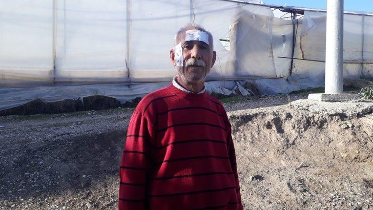 Seralarını kontrol ederken maganda kurşunuyla başından yaralandı G2