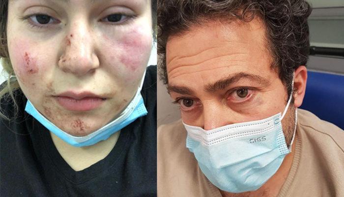 Almanya'da polisin kızıyla birlikte dövdüğü Türk konuştu
