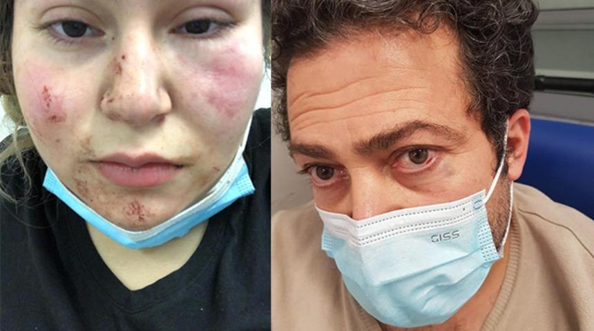 Almanya'da polisin kızıyla birlikte dövdüğü Türk konuştu