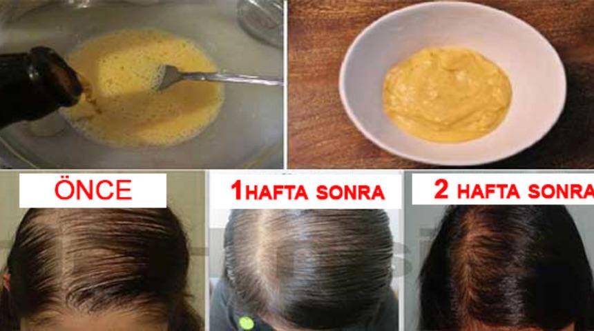 Mutfağınızdaki bu 3 ürün saç dökülmenizi aniden durduruyor!