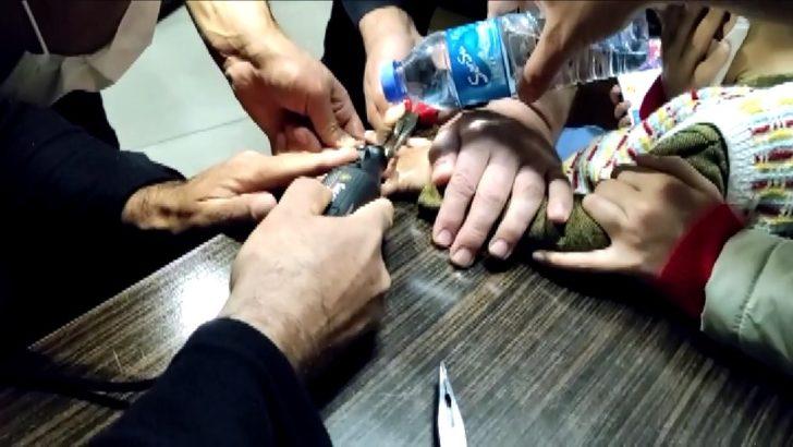 ‘Yüzük’ diye taktığı metal pulu itfaiye çıkarttı G2