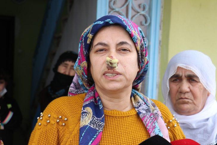 Sokak köpeklerinin saldırdığı kadın yaralandı G2