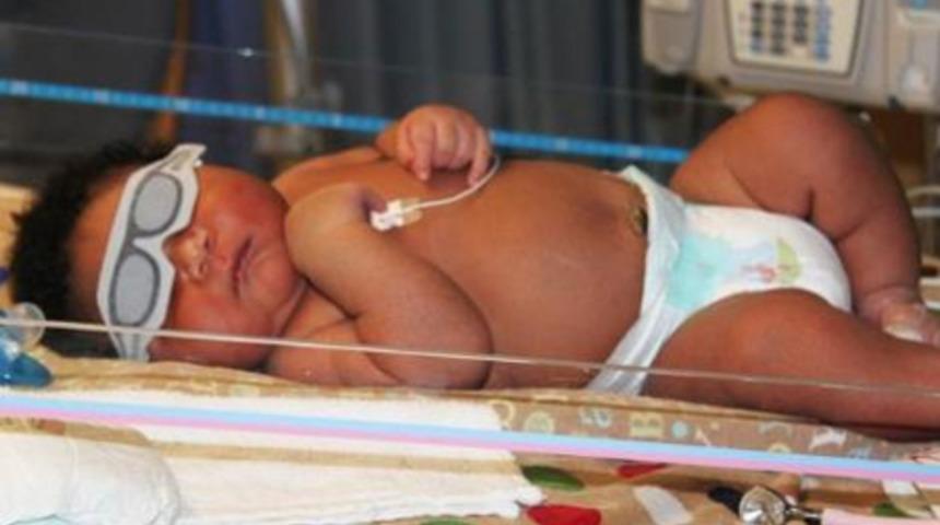 7 Kilo doğdu!