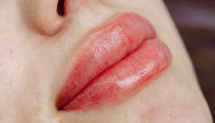 Kalıcı dudak makyajı nasıl yapılıyor? Kalıcılığı 5 yıl sürerken, iyileşme sürecinde öpüşmekten kaçının!