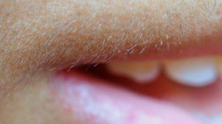 Polikistik over sendromu böyle belirti veriyor! Erkek tipi kıllanma ve...