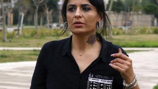 Güzellik merkezinde yüzü yanan Aslı: Sosyal medyadaki reklamlarına kandım