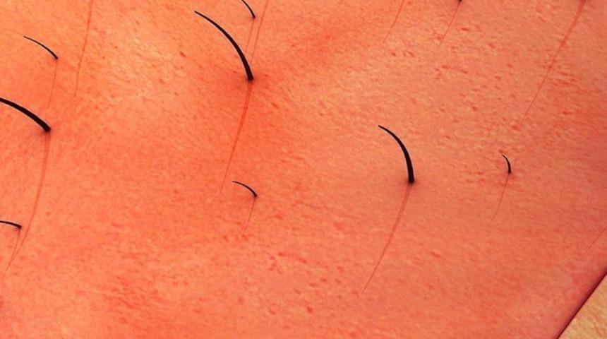 Kıl dönmesi hakkında yanlış bilinenler