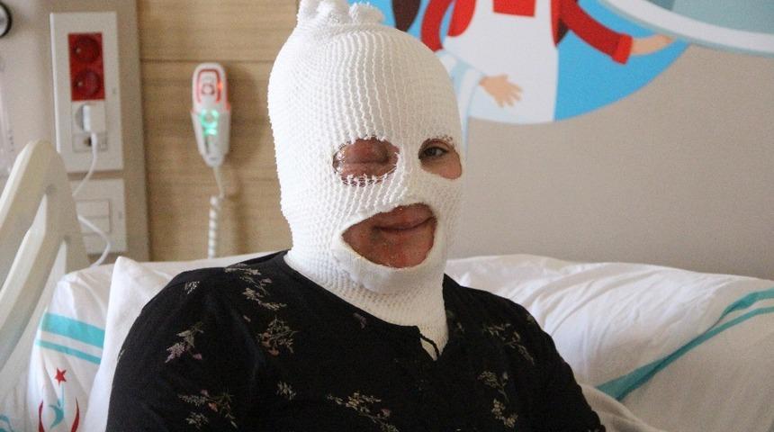 Bayburt&rsquo;ta kaynar su &uuml;zerine d&ouml;k&uuml;len kadın hastanelik oldu