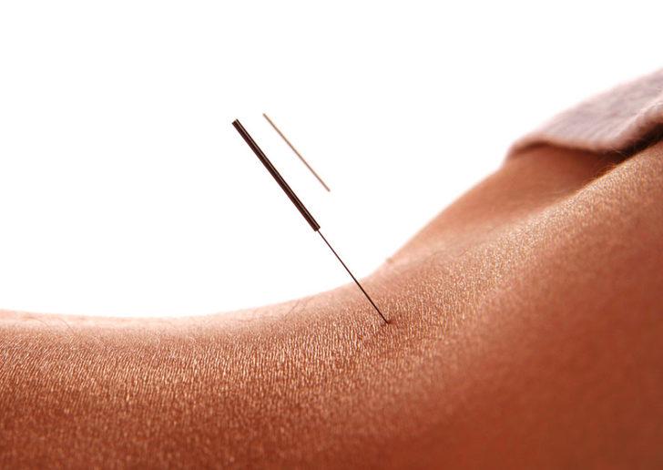 Tıpta çığır açacak gelişme: O tedavi buna da iyi geliyor! İğne deyip geçmeyin G1