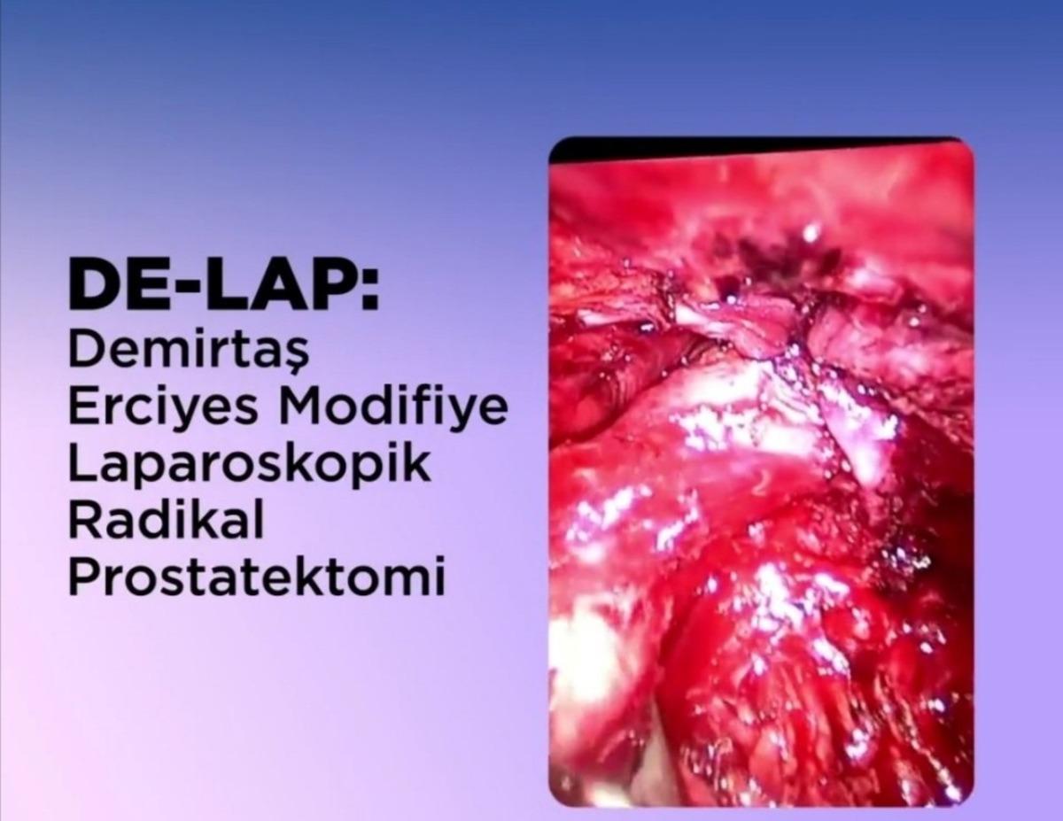 ER&Uuml;&rsquo;den Prostat Kanseri Tedavisinde Yerli Ve Milli Tedavi Y&ouml;ntem: DE-LAP