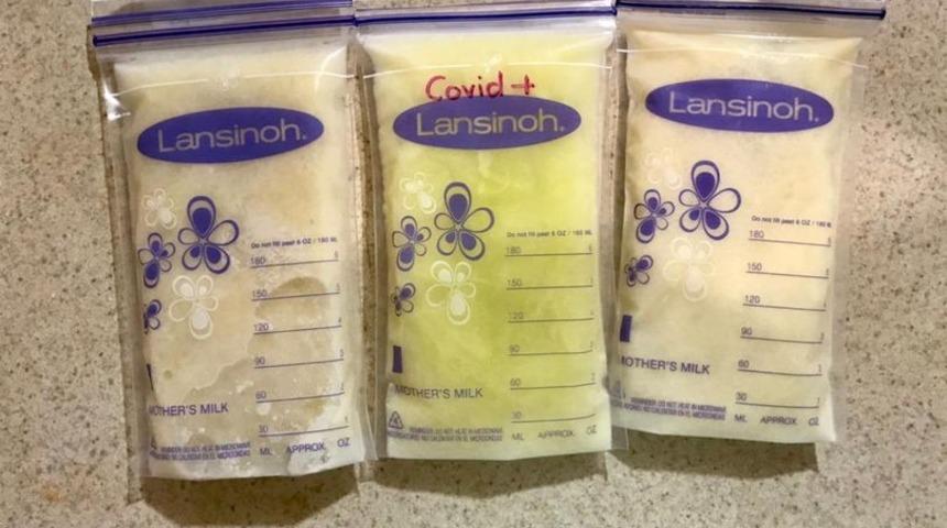 Meksika’da koronavirüse yakalanan annenin sütü açık yeşil oldu