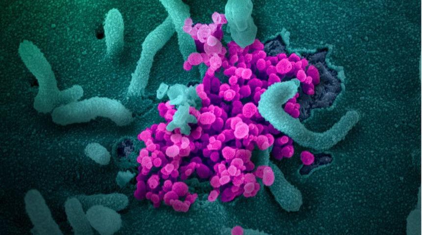 Mutasyon: Bilim Kurulu üyesi Prof. Tezer, Türkiye'ye özgü koronavirüs varyantlarının çıktığını açıkladı