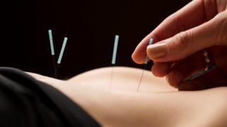 İğnenin ucundaki şifa! Akupunktur yöntemiyle adet düzensizliği nasıl tedavi edilir?