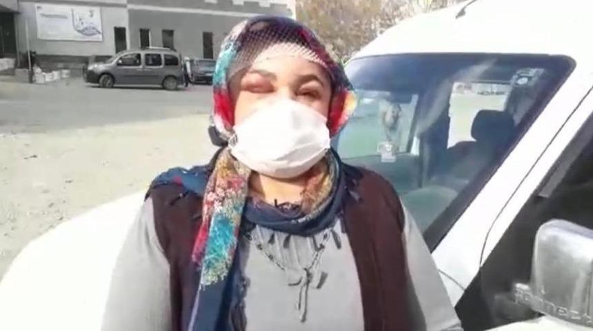 Miras y&uuml;z&uuml;nden darp edilen kadın: "Babam gibi &ouml;ld&uuml;r&uuml;lmek istemiyorum"