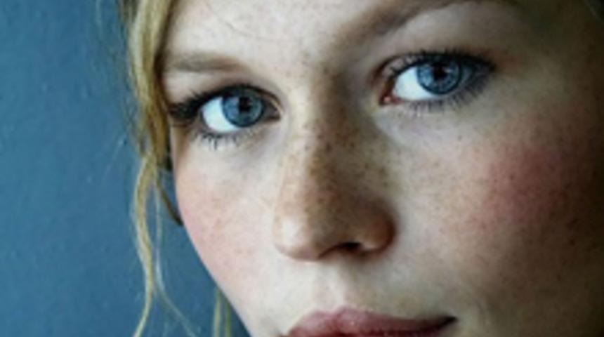 Cilt Lekelerine &Ccedil;&ouml;z&uuml;m: Lazer