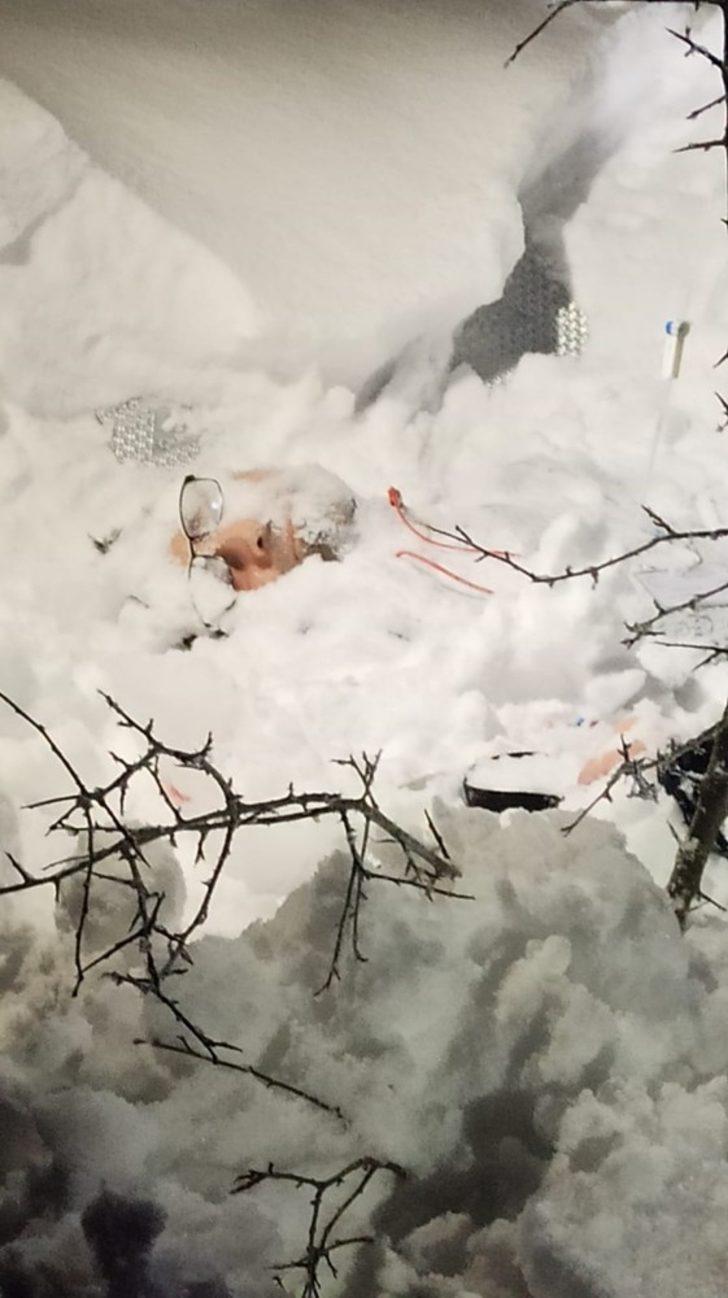 Eksi 10 derece narkozla ölüm uykusu G4