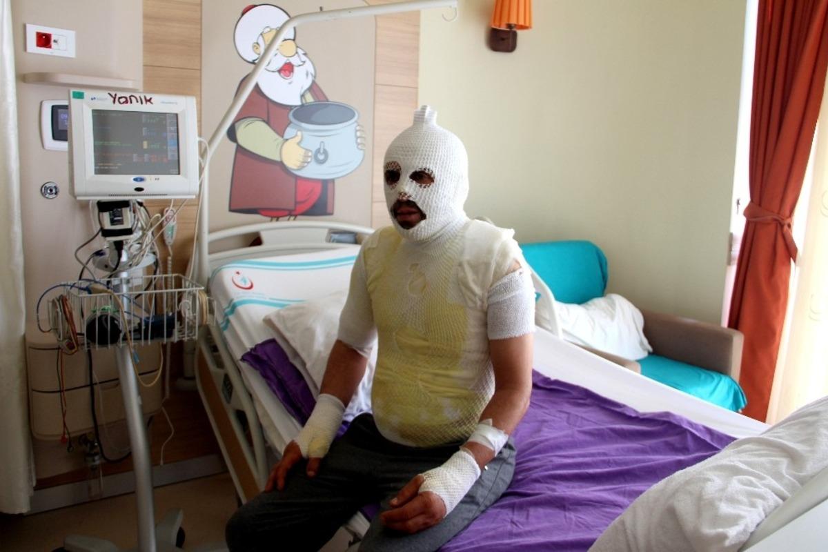 Akrabaları tarafından kaynar suyla yakıldığını iddia etti