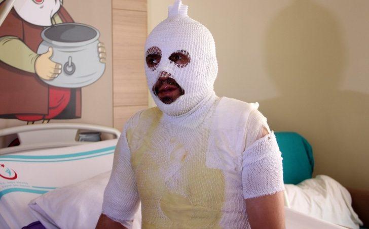 Akrabaları tarafından kaynar suyla yakıldığını iddia etti G3