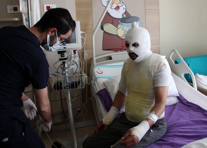 Akrabaları tarafından kaynar suyla yakıldığını iddia etti G4