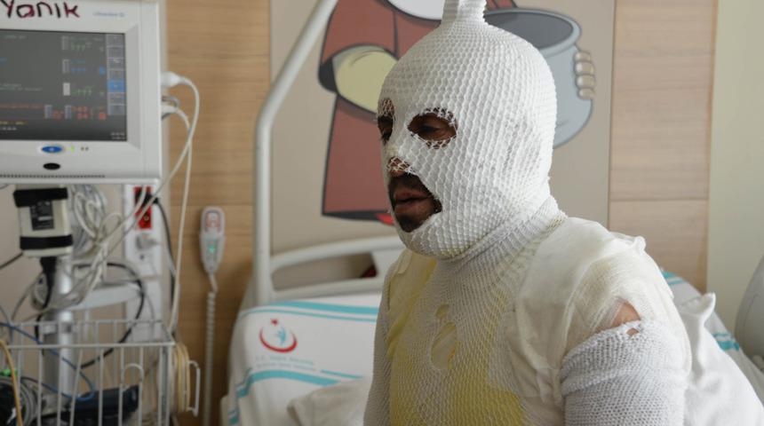 'Eşimi taciz ettin' dedi, kaynar suyla haşladı