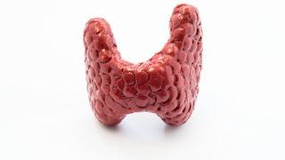 Guatr nedeniyle nefes alamıyordu! 8 yıl sonra sağlığına kavuştu