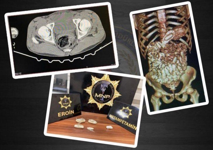 Midesinde uyuşturucu sevkiyatı yapan 2 kişi, polisin dikkati sayesinde yakalandı G4