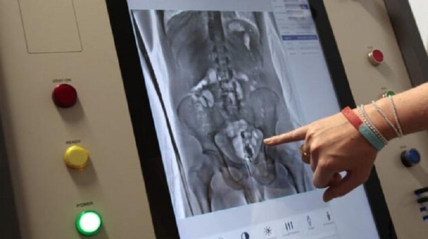 Yunanistan'da cezaevinden izinli çıkan mahkumun makatından iki adet cep telefonu çıktı