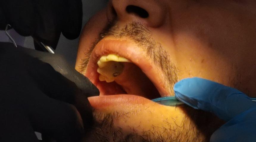 Diş eti hastalığı Covid-19 nedeniyle ölüm oranını 9 kat artırıyor!