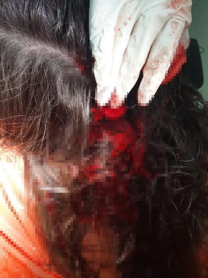 (Özel) İstanbul’da pitbull dehşeti G3