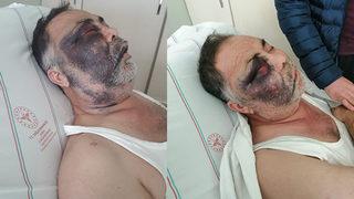 Yüzde 90 engelli adamı öldüresiye darp ettiler