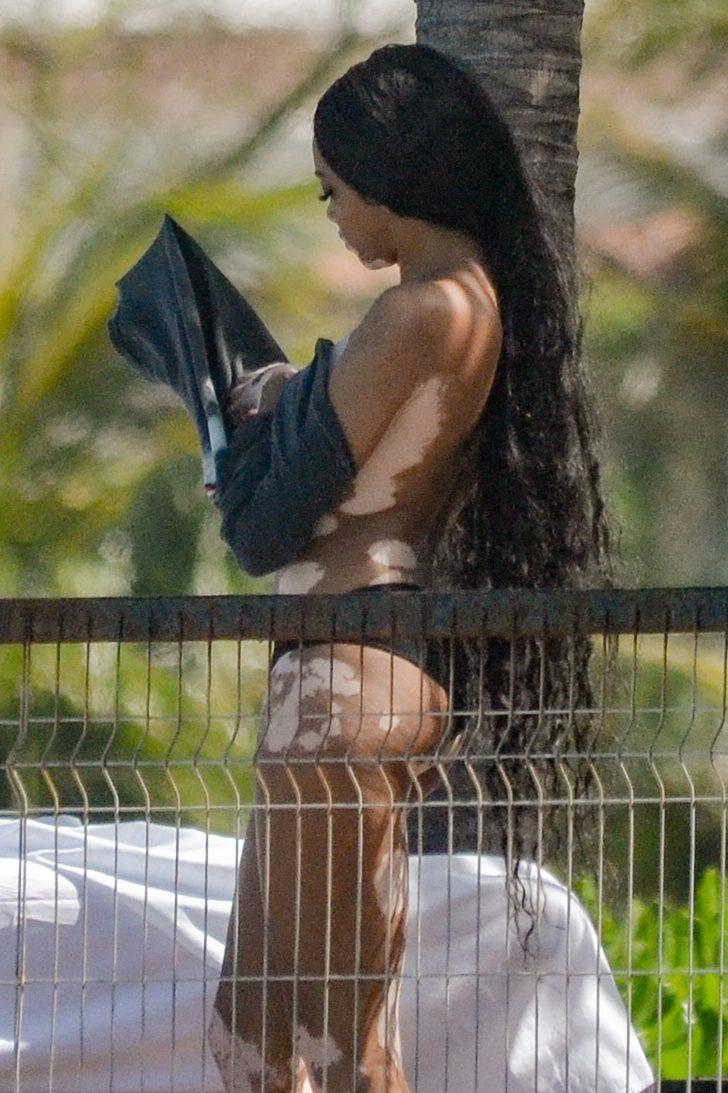 Winnie Harlow herkesin içinde üstsüz kaldı! Umursamadı G5