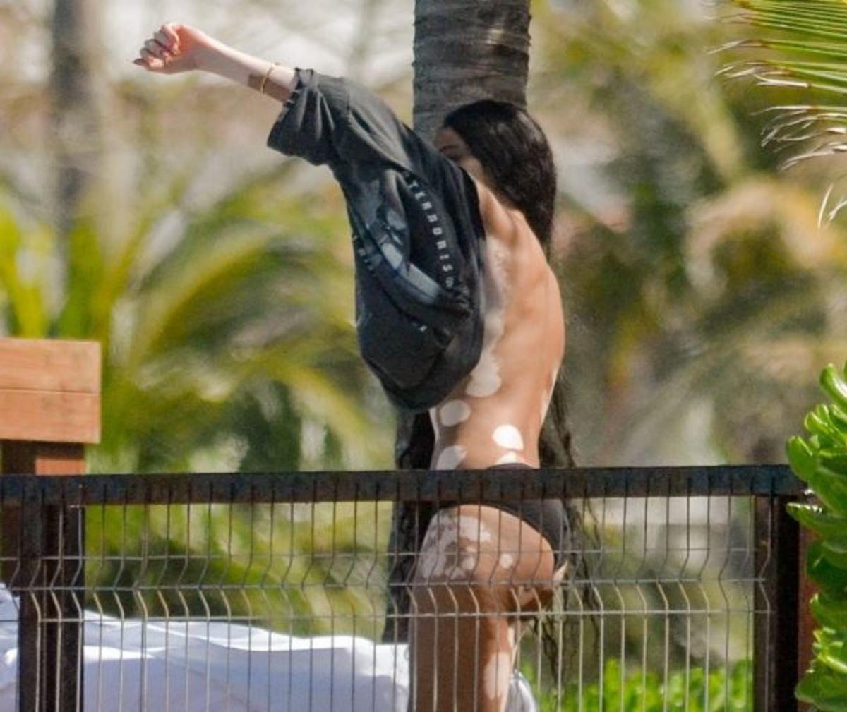 Winnie Harlow herkesin i&ccedil;inde &uuml;sts&uuml;z kaldı! Umursamadı