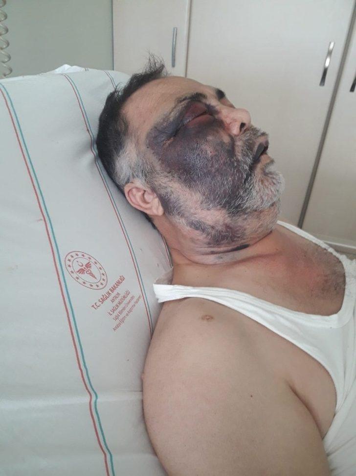 Hastanelik olan yüzde 90 engelli vatandaşı darp ettiği iddia edilen şüpheliler adli kontrol şartıyla serbest G3