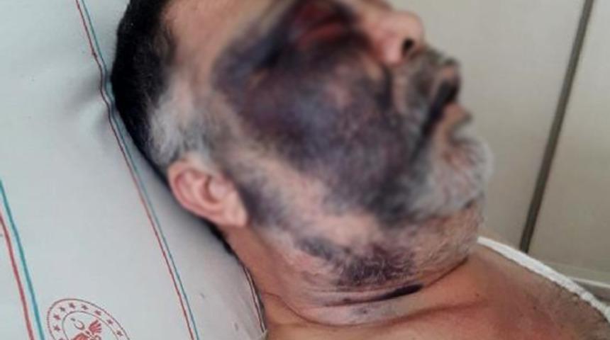 Dehşete düşüren olay! Engelli adam ile ailesini darp ettiler