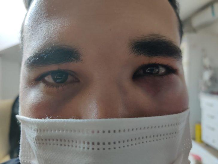 Hemşireye saldırı anı kamerada G3