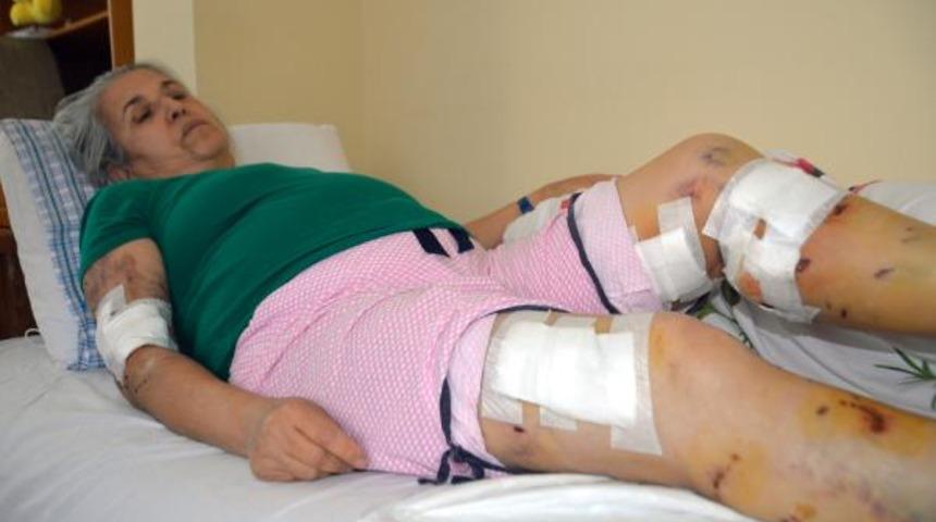 Sokak köpeklerinin saldırısına uğradı, ölümden döndü