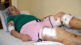 Sokak köpeklerinin saldırısına uğradı, ölümden döndü