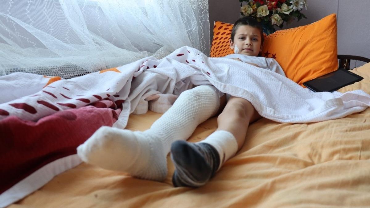 K&uuml;&ccedil;&uuml;k &ccedil;ocuk 15 dikişle kurtulduğu pitbull dehşetini b&ouml;yle anlattı:
