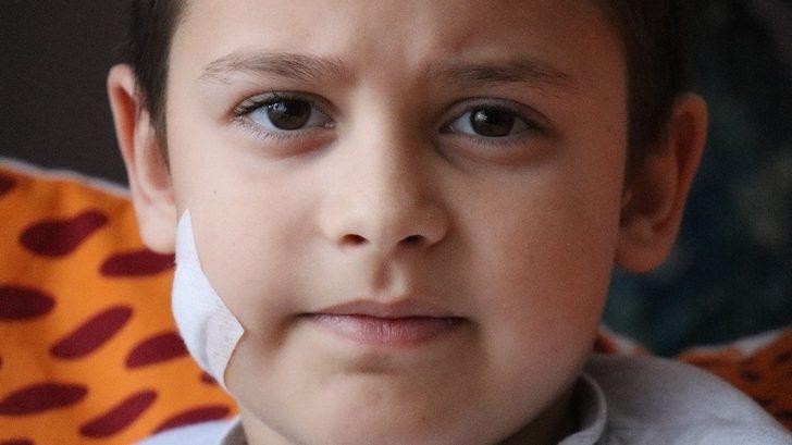 Küçük çocuk 15 dikişle kurtulduğu pitbull dehşetini böyle anlattı: G3