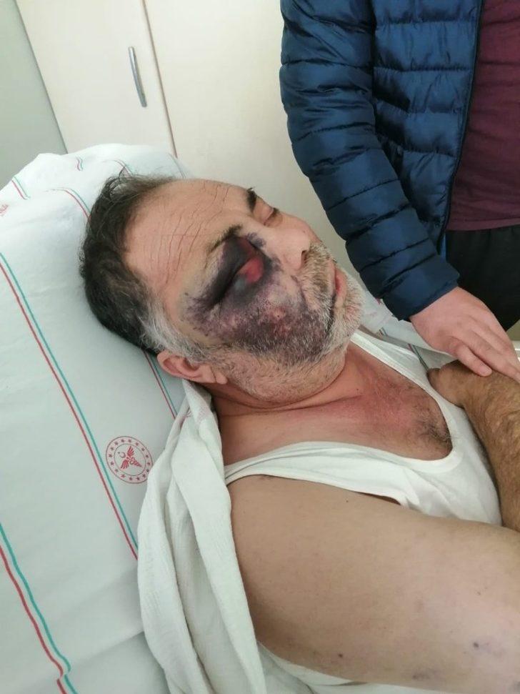 Darp iddiasıyla hastanelik olan yüzde 90 engelli vatandaş olayında flaş gelişme G4