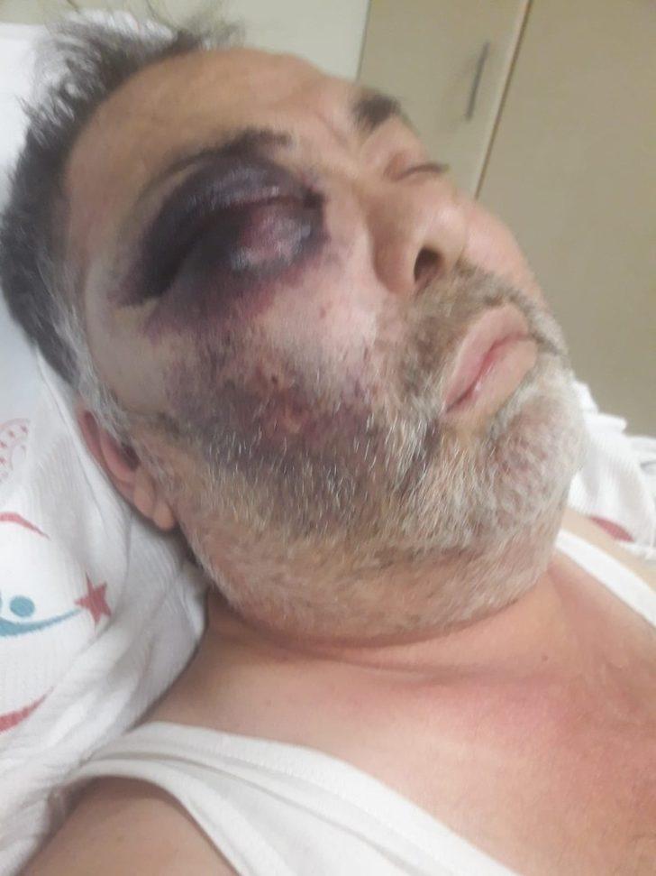 Darp iddiasıyla hastanelik olan yüzde 90 engelli vatandaş olayında flaş gelişme G5